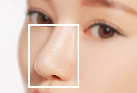  隆鼻手术有哪些危害？隆鼻当心这5种后遗症
