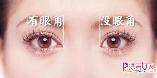 开眼角后疤痕增生怎么办 怎么避免开眼角术后留疤
