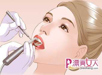  超声波洗牙会伤害牙齿吗？超声波洁牙的误区