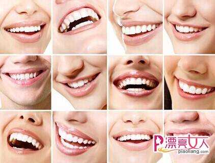  适合全瓷牙的人群  什么因素会影响全瓷牙的使用寿命
