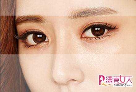  韩式双眼皮维持多久的时间？术后怎么护理