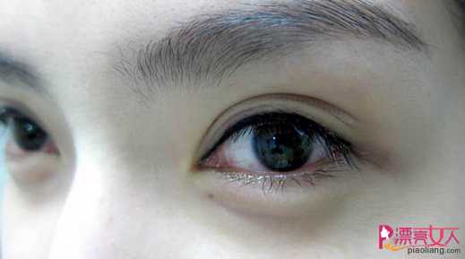  韩式半永久美瞳线　哪些人需要纹美瞳线?