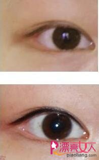  韩式半永久美瞳线和纹眼线的区别