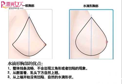  隆胸新概念：韩式水滴型胸部