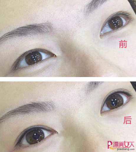  韩式半永久化妆——纹眼线成功案例
