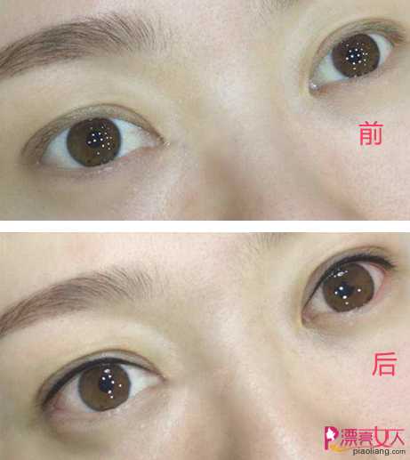  韩式半永久化妆——纹眼线成功案例