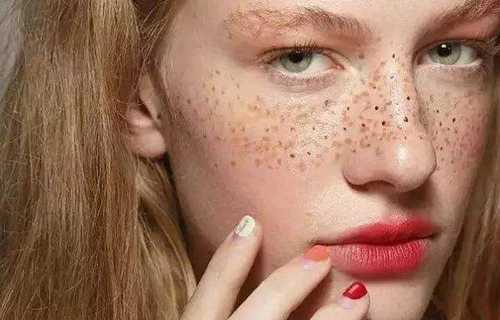  干性皮肤为什么容易长斑？色斑和皮肤干的联系