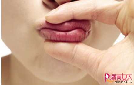  冬季嘴唇干裂的5大原因 护唇禁忌你知道多少？