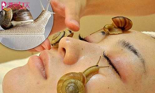  蜗牛美容正流行 另类护肤可不可信？