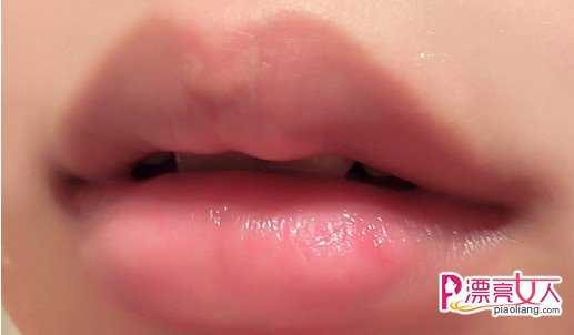  秋季如何做唇部护理保养 简单6步拥有樱桃般嘴唇