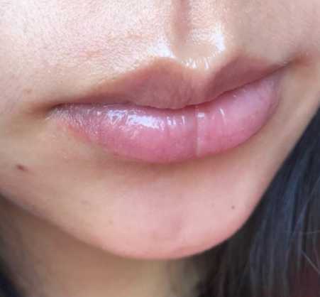 几个坏习惯，会让唇部越来越丑，不改掉很难提升颜值