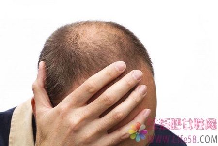  年轻人掉头发如何调理 遗传性脱发能治好吗？