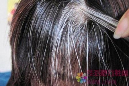 头发白了原因和如何避免增加数量？3种方法防止白头发