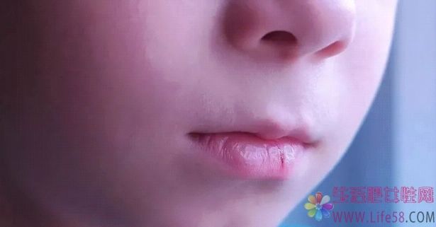 为什么一到秋天嘴唇就起皮？润唇膏用得越多越好吗？